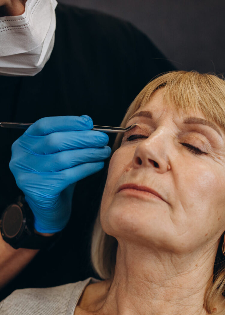 Estetica e Sorriso - Blefaroplastica Estetica e Sorriso - Blefaroplastica