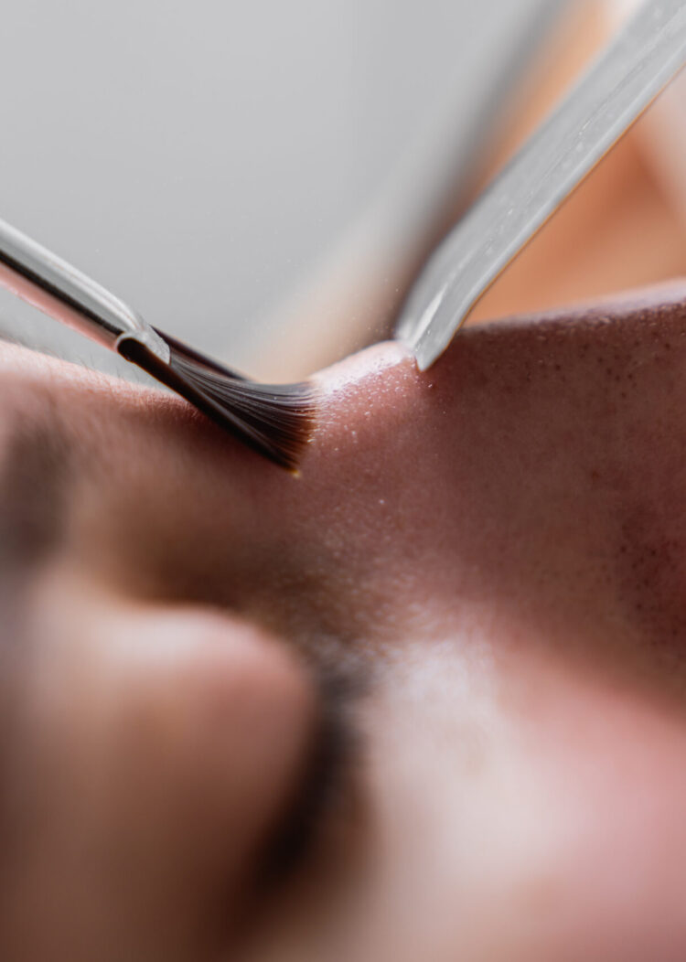 Estetica e Sorriso - Rinoplastica Estetica e Sorriso - Rinoplastica