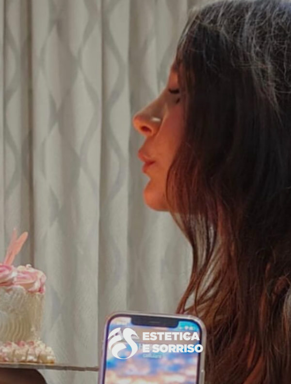 Rinoplastica - Estetica e Sorriso